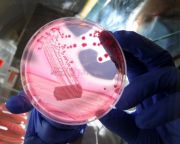 Bioaktív üveg segíthet az E. coli-fertőzés ellen