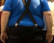 Riasztóan elterjedt az elhízás az iparilag fejlett országokban