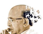 Magyar tudósok felfedezése lassíthatja az Alzheimer-kór tüneteinek romlását
