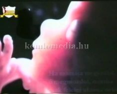 Az abortuszról... (Hertbertné Sipos Csilla)